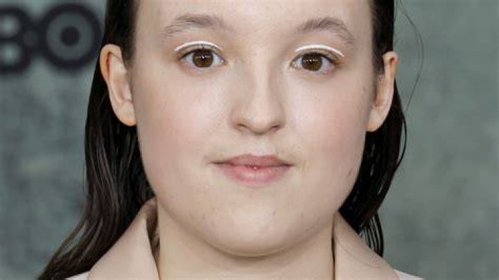 Does Bella Ramsey Have Fetal Alcohol Syndrome? What&rsquo;s Wrong With the